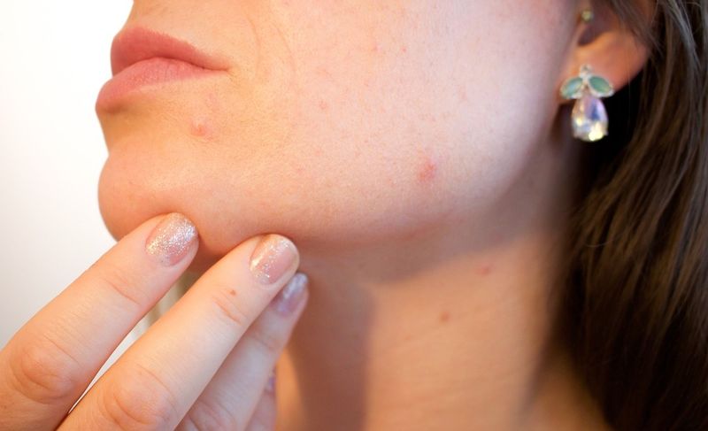 Dermatology Medical Assistant Salary How To Become More